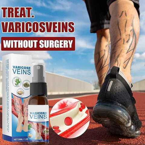 Varicose Veins Treatment
