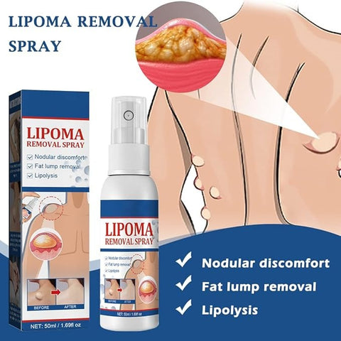 LIPOMA REMOVAL SPRAY (IMPORTED)